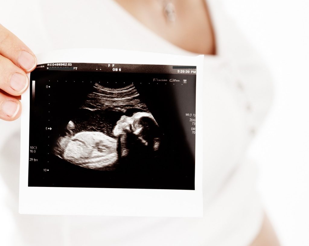 Seine Ex ist von ihm schwanger, das gefährdet unsere junge Liebe!