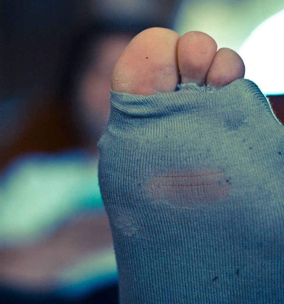 Mein Freund pflegt sich zu wenig, mir vergeht allmählich die Lust auf ihn!